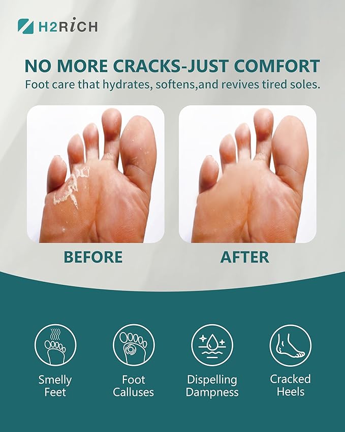 Hydrogen Foot Soak Effervescent Tablets 6 Pack | Ginger & Mugwort Herb Foot Bath, Relaxing Spa Pedicure Care | Improves Circulation, Soothes Tired Feet, Softens Calluses, Controls Odor