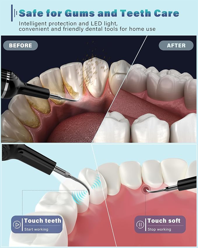 Plaque Remover for Teeth, Dental Cleaning Kit Tartar Remover for Teeth - Image 2
