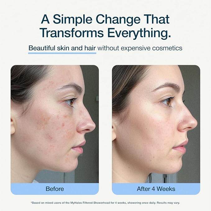 MyHalos® Filtered Shower Head for Hard Water Filter - Image 7
