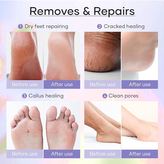 Epsom Salt Soak, Callus Remover Gel, Extreme Sugar Scrub, Collagen Mask & Shea Butter Lotion – Professional Spa Foot Care System 5 Step Luxury Pedicure Kit. Orange 12 Set